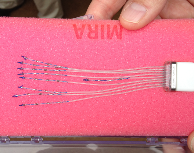 A prototype of an implantable device that receives signals from different muscle groups and transmits them to a robotic limb.